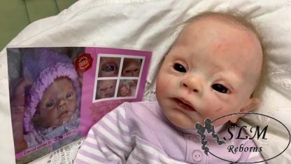 PEBBLES 2 downs syndrome baby - - Image 31