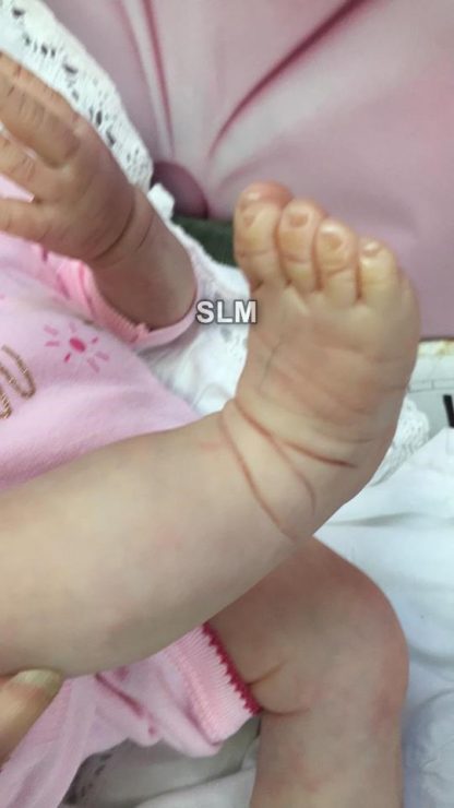 PEBBLES 2 downs syndrome baby - - Image 9