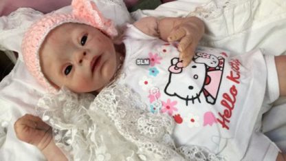 PEBBLES 2 downs syndrome baby - - Image 11