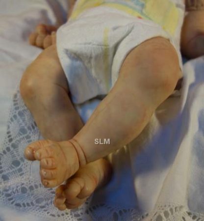 PEBBLES , downs syndrome baby, no. 535 - Image 15
