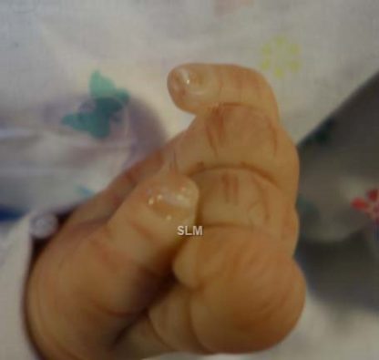 PEBBLES , downs syndrome baby, no. 535 - Image 2